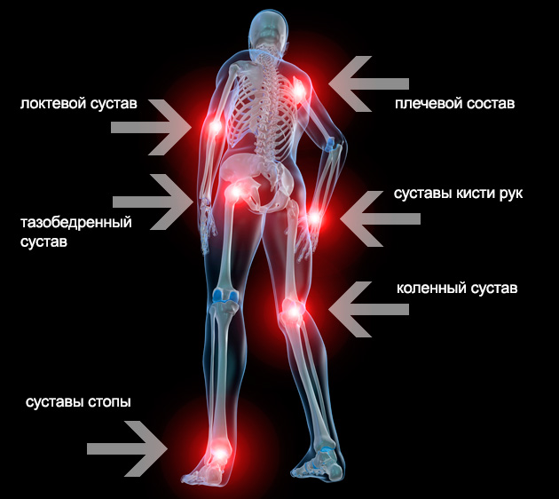 Хрустят плечевые суставы что делать как лечить Хрустят плечевые суставы что делать как лечить