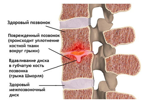 Как быстро похудеть - VK